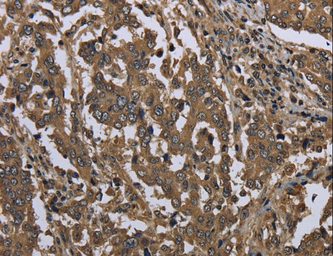 Polyclonal Rabbit anti-Human GOLGA2 / GM130 Antibody (IHC, WB)