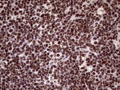 XRN2 Antibody (aa677-779, clone OTI5F4)