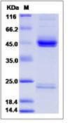Marmoset IL23 Protein (Recombinant His,C-terminus)