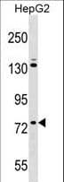 ZNF540 Antibody (aa67-96)
