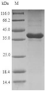 Rat GREM1 / Gremlin-1 Protein (Recombinant 6His-SUMO, N-terminus)