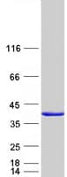 Human CDC34 Protein (Recombinant Myc-DDK (Flag))