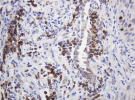 RPN2 / Ribophorin II Antibody (clone OTI1G9)