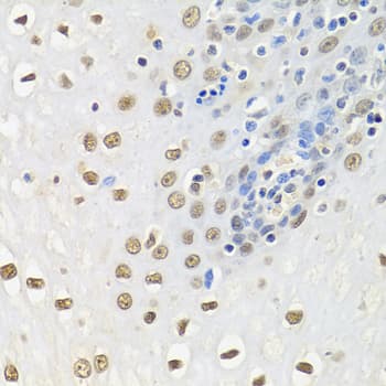 ELAVL1 / HUR Antibody