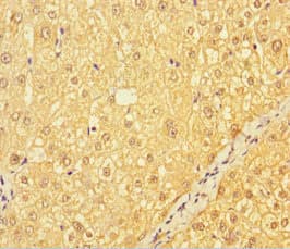 CATSPER4 Antibody