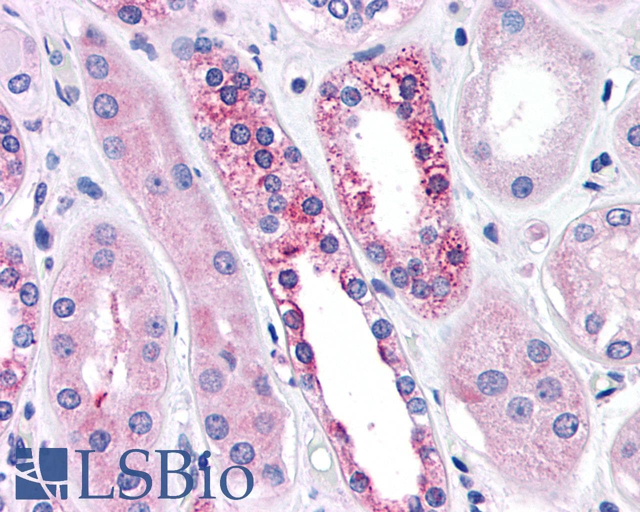 PathPlus™ CASR/Calcium Sensing Receptor Antibody (N-Terminus)