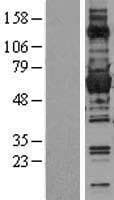 Human G6PD Protein (Over-Expression Lysate Myc-DDK (Flag))