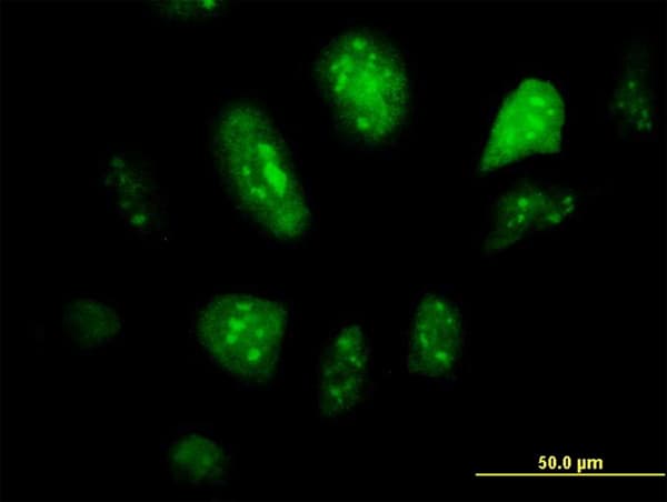 Monoclonal Mouse anti-Human GCM1 Antibody (clone 2E11, IF, WB)