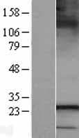 SARA2 / SAR1B Protein (Over-Expression Lysate Myc-DDK (Flag))