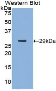 ITGAD / CD11d Antibody (aa886-1106)