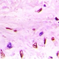 FUBP1 Antibody