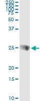 Monoclonal Mouse anti-Human SNAP23 / SNAP-23 Antibody (clone 2F5-3D4, IHC, WB)