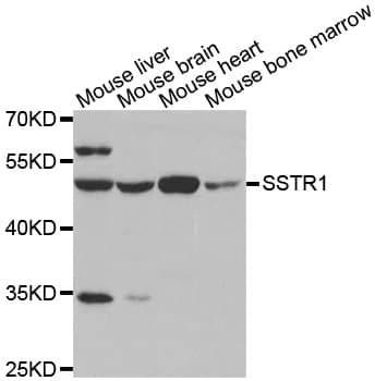 SSTR1 Antibody