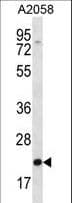 IHC-plus™ FGF11 / FGF-11 Antibody (aa1-30)