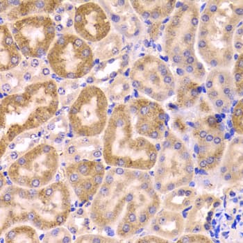 CYP51A1 / CYP51 Antibody