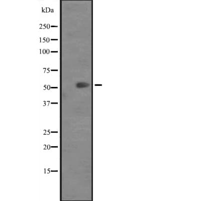 Polyclonal Rabbit anti-Human KRT82 / Keratin 82 / KRTHB2 Antibody (WB)