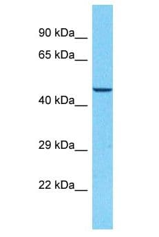 CACNB3 / Cavbeta3 Antibody (aa421-470)