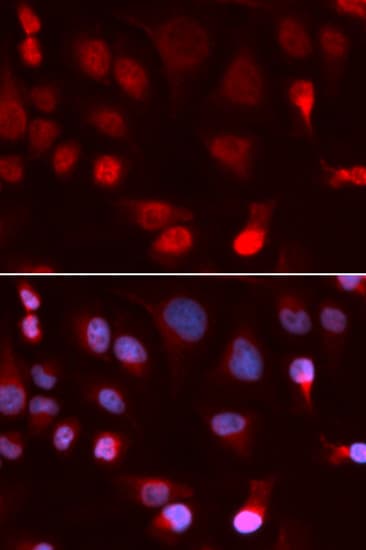 WC1 / ATP7B Antibody