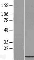 BRP44L Protein (Over-Expression Lysate Myc-DDK (Flag))
