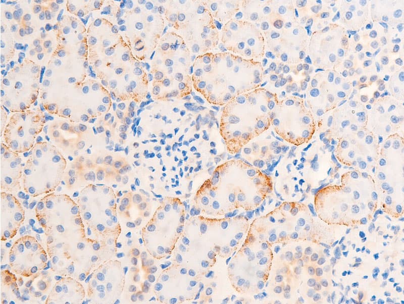 Polyclonal Rabbit anti-Human CHEK1 / CHK1 Antibody (phospho-Ser317, IHC, IF, WB)