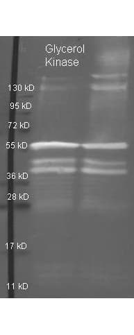 GK / Glycerol Kinase Antibody (Lyophilized)