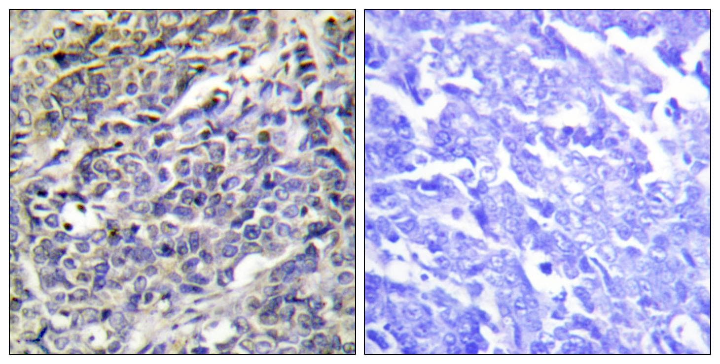 GZMK / Granzyme K Antibody