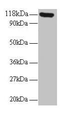 SNCA / Alpha-Synuclein Antibody