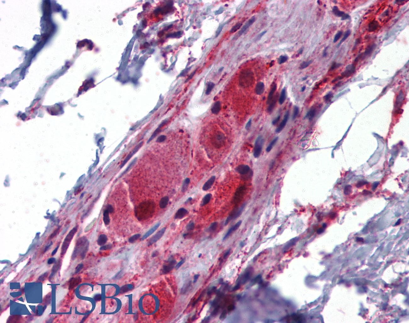 Polyclonal Rabbit anti-Rat NGFR / CD271 / TNR16 Antibody (C-Terminus, IHC, WB)