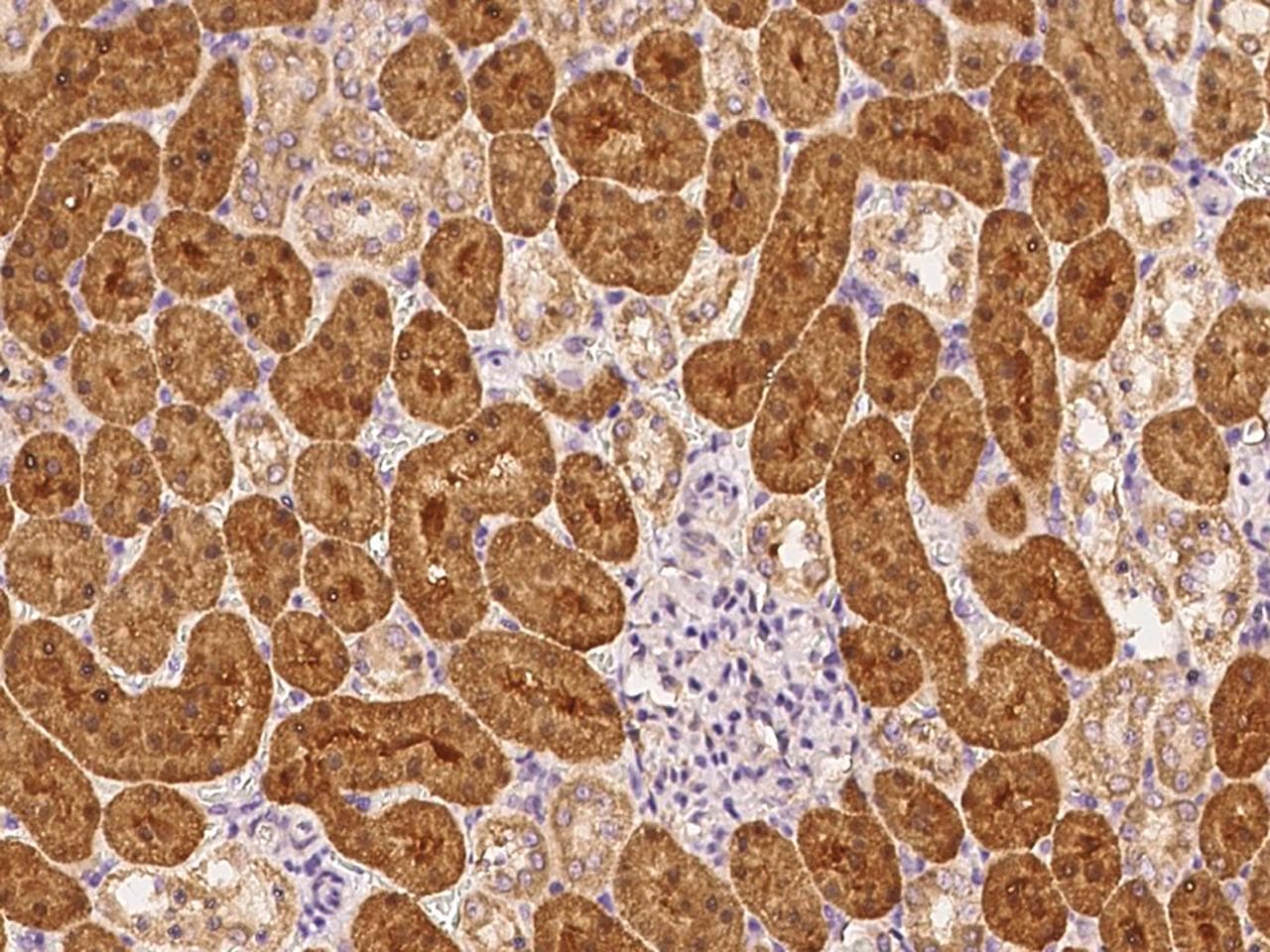 RAB1A Antibody (Preservative Free)