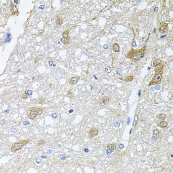 RAPSN Antibody (AP)