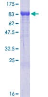 Human ALOX15B / 15-LOX-2 Protein (Recombinant GST)