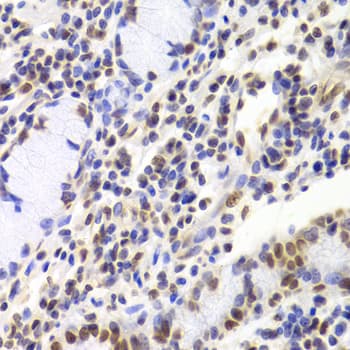 XRCC5 / Ku80 Antibody