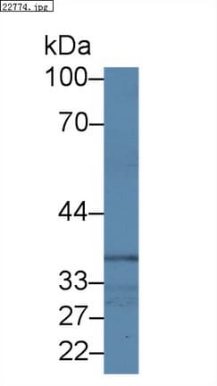 NCK1 / NCK Antibody (aa2-377, PE)