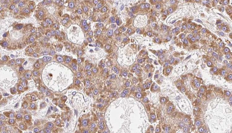 Polyclonal Rabbit anti-Human CPD Antibody (IHC, IF, WB)