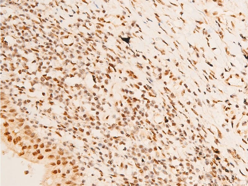 SGK1 / SGK Antibody (phospho-Ser422)