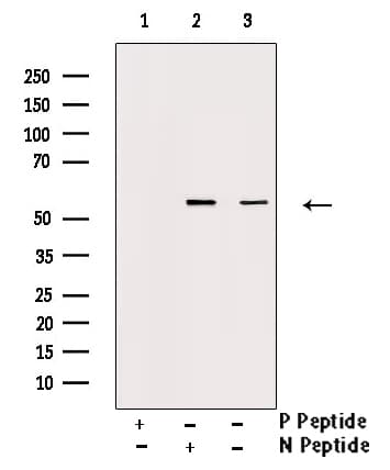 CHEK1 / CHK1 Antibody (phospho-Ser286)