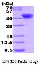 Human AKR7A2 / AFAR Protein (Recombinant His)
