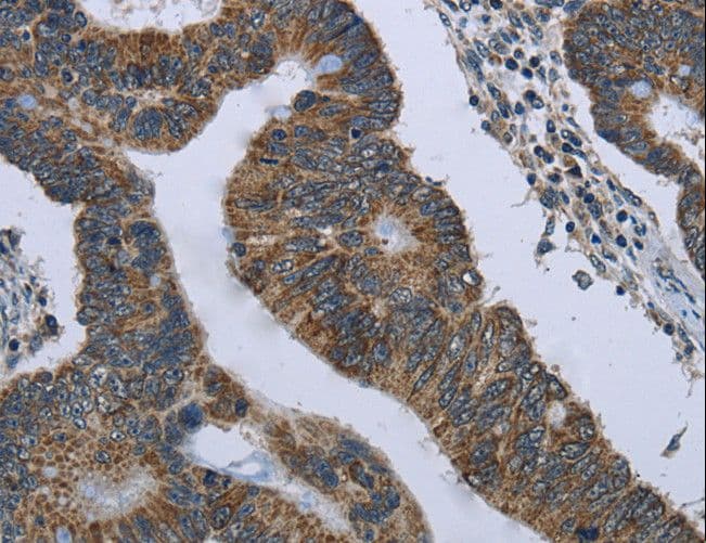GYPC / Glycophorin C Antibody