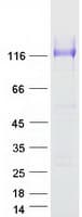Human SUSD1 Protein (Recombinant Myc-DDK (Flag))