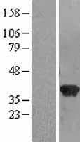 Human RABGGTB Protein (Over-Expression Lysate Myc-DDK (Flag))