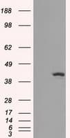 IDH1 / IDH Antibody (clone OTI2H9)