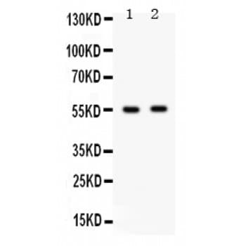 GABRB3 Antibody (aa344-375)