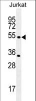 Polyclonal Rabbit anti-Human CHRNA2 Antibody (aa42-69, WB)