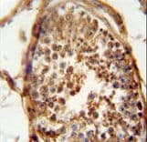 DNAJB13 Antibody (aa176-205)