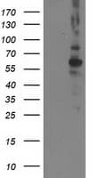 PPM1B Antibody (clone OTI3F2)