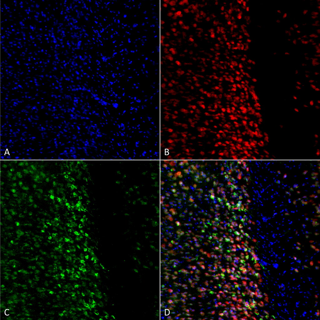 SNCA / Alpha-Synuclein Antibody (phospho-Ser129, APC)