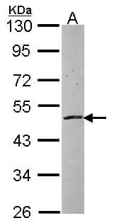 Polyclonal Rabbit anti-Human ZNF140 Antibody (aa28-440, WB)