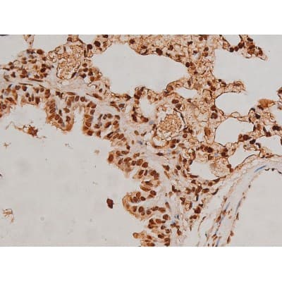 Polyclonal Rabbit anti-Human EZR / Ezrin Antibody (phospho-Tyr353, IF, WB)