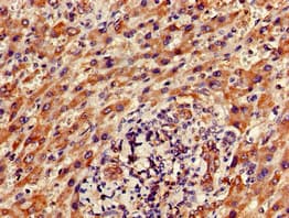 Polyclonal Rabbit anti-Human FAM111A Antibody (IHC, IF)