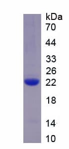 Human AGR2 Protein (Recombinant His)